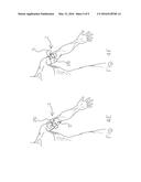 BATTLE APPLICATION TOURNIQUET FOR LIMB diagram and image