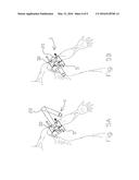 BATTLE APPLICATION TOURNIQUET FOR LIMB diagram and image