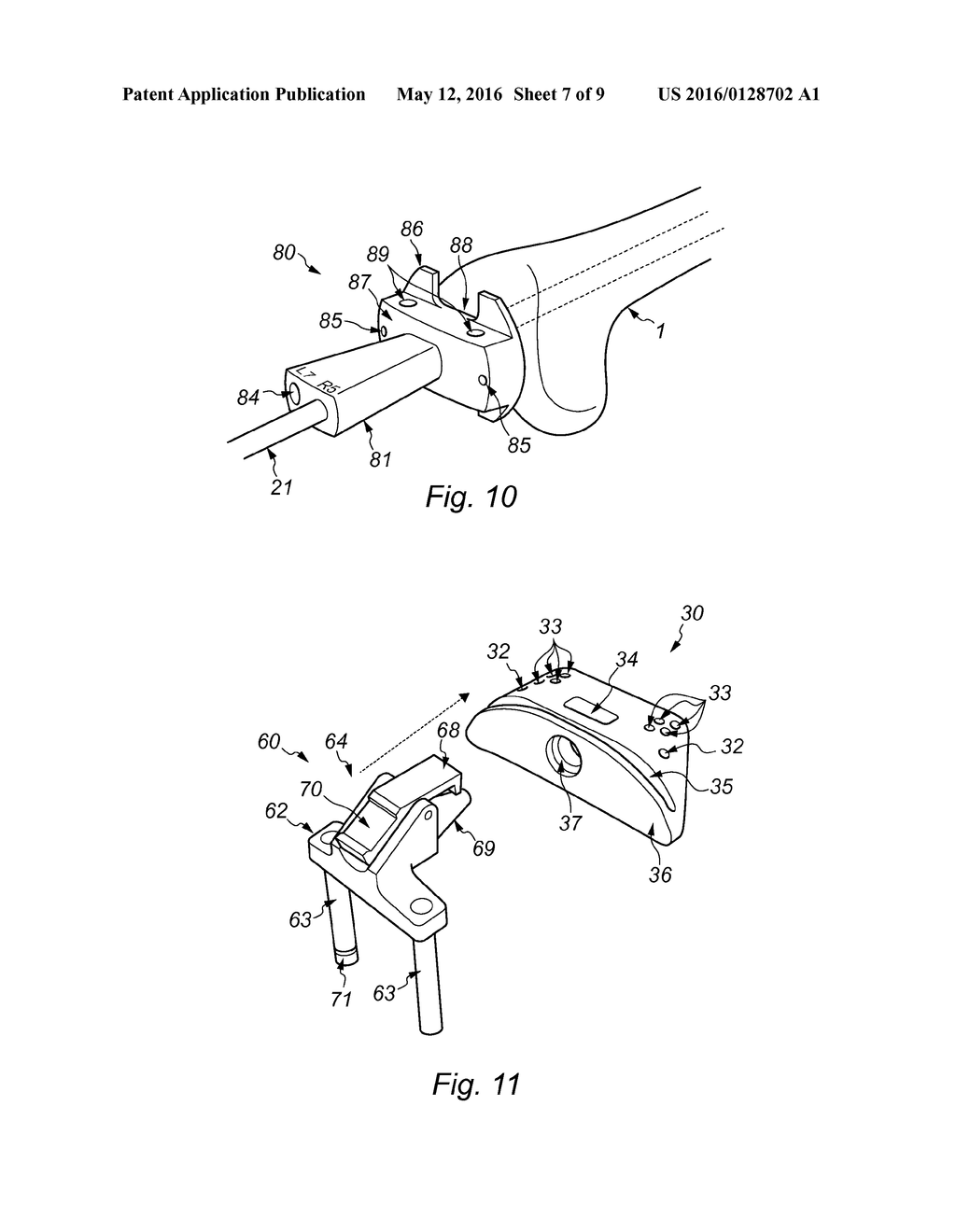 DISTAL FEMORAL JIG ASSEMBLY - diagram, schematic, and image 08