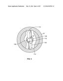 TISSUE DISPLACEMENT TOOLS AND METHODS diagram and image