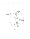 TISSUE DISPLACEMENT TOOLS AND METHODS diagram and image