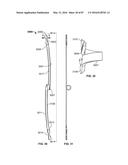 TISSUE DISPLACEMENT TOOLS AND METHODS diagram and image