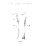 TISSUE DISPLACEMENT TOOLS AND METHODS diagram and image