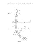 TISSUE DISPLACEMENT TOOLS AND METHODS diagram and image