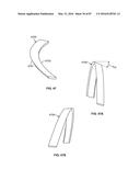 TISSUE DISPLACEMENT TOOLS AND METHODS diagram and image