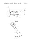 TISSUE DISPLACEMENT TOOLS AND METHODS diagram and image