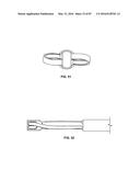 TISSUE DISPLACEMENT TOOLS AND METHODS diagram and image