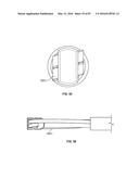 TISSUE DISPLACEMENT TOOLS AND METHODS diagram and image