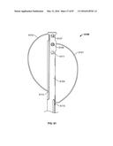 TISSUE DISPLACEMENT TOOLS AND METHODS diagram and image