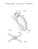 TISSUE DISPLACEMENT TOOLS AND METHODS diagram and image