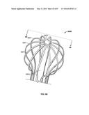 TISSUE DISPLACEMENT TOOLS AND METHODS diagram and image