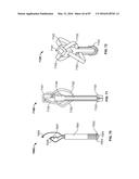 TISSUE DISPLACEMENT TOOLS AND METHODS diagram and image