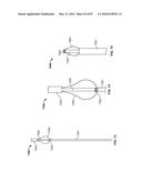 TISSUE DISPLACEMENT TOOLS AND METHODS diagram and image