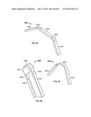 TISSUE DISPLACEMENT TOOLS AND METHODS diagram and image