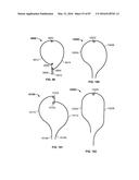 TISSUE DISPLACEMENT TOOLS AND METHODS diagram and image