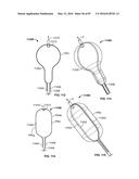 TISSUE DISPLACEMENT TOOLS AND METHODS diagram and image