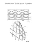 TISSUE DISPLACEMENT TOOLS AND METHODS diagram and image