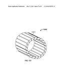 TISSUE DISPLACEMENT TOOLS AND METHODS diagram and image