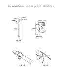 TISSUE DISPLACEMENT TOOLS AND METHODS diagram and image