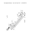 TISSUE DISPLACEMENT TOOLS AND METHODS diagram and image