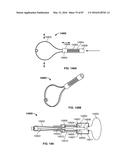 TISSUE DISPLACEMENT TOOLS AND METHODS diagram and image