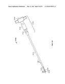 TISSUE DISPLACEMENT TOOLS AND METHODS diagram and image