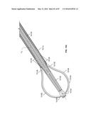 TISSUE DISPLACEMENT TOOLS AND METHODS diagram and image