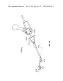 TISSUE DISPLACEMENT TOOLS AND METHODS diagram and image