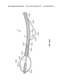 TISSUE DISPLACEMENT TOOLS AND METHODS diagram and image