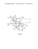 TISSUE DISPLACEMENT TOOLS AND METHODS diagram and image