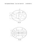 SURGICAL ACCESS SYSTEM WITH NAVIGATION ELEMENT AND METHOD OF USING SAME diagram and image