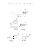 SURGICAL ACCESS SYSTEM WITH NAVIGATION ELEMENT AND METHOD OF USING SAME diagram and image