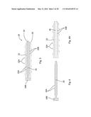 SUBCUTANEOUS IMPLANTABLE DEVICE FOR GRADUALLY ALIGNING A SPINE AND     SUBCUTANEOUS IMPLANTABLE DEVICE FOR GRADUALLY LENGTHENING A BONE diagram and image