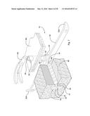 SUBCUTANEOUS IMPLANTABLE DEVICE FOR GRADUALLY ALIGNING A SPINE AND     SUBCUTANEOUS IMPLANTABLE DEVICE FOR GRADUALLY LENGTHENING A BONE diagram and image