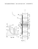 SUBCUTANEOUS IMPLANTABLE DEVICE FOR GRADUALLY ALIGNING A SPINE AND     SUBCUTANEOUS IMPLANTABLE DEVICE FOR GRADUALLY LENGTHENING A BONE diagram and image