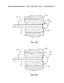 SUBCUTANEOUS IMPLANTABLE DEVICE FOR GRADUALLY ALIGNING A SPINE AND     SUBCUTANEOUS IMPLANTABLE DEVICE FOR GRADUALLY LENGTHENING A BONE diagram and image