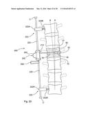 SUBCUTANEOUS IMPLANTABLE DEVICE FOR GRADUALLY ALIGNING A SPINE AND     SUBCUTANEOUS IMPLANTABLE DEVICE FOR GRADUALLY LENGTHENING A BONE diagram and image