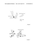 NOVEL TECHNIQUES FOR REDUCTION OF BASILAR INVAGINATION AND ATLANTO AXIAL     DISLOCATION AND SURGICAL INSTRUMENTS THEREOF diagram and image