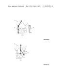 NOVEL TECHNIQUES FOR REDUCTION OF BASILAR INVAGINATION AND ATLANTO AXIAL     DISLOCATION AND SURGICAL INSTRUMENTS THEREOF diagram and image