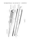 SURGICAL DEVICE FOR THE REMOVAL OF TISSUE EMPLOYING A VIBRATING BEAM WITH     COLD PLASMA STERILIZATION diagram and image