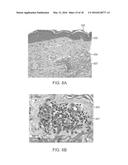 Controlled Photomechanical and Photothermal Treatment of Mucosal Tissue diagram and image