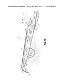 SCISSOR MOUNTED BLOOD SPRAY SHIELD diagram and image