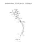 CURVED CANNULA SURGICAL SYSTEM diagram and image