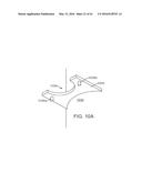 CURVED CANNULA SURGICAL SYSTEM diagram and image