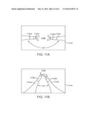 CURVED CANNULA SURGICAL SYSTEM diagram and image