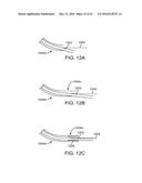 CURVED CANNULA SURGICAL SYSTEM diagram and image