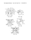 CURVED CANNULA SURGICAL SYSTEM diagram and image