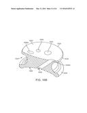 CURVED CANNULA SURGICAL SYSTEM diagram and image