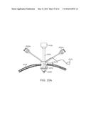 CURVED CANNULA SURGICAL SYSTEM diagram and image