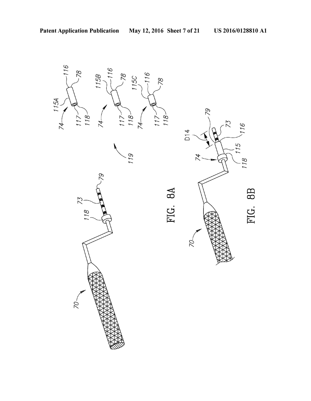 GUIDED SINUS LIFT - diagram, schematic, and image 08